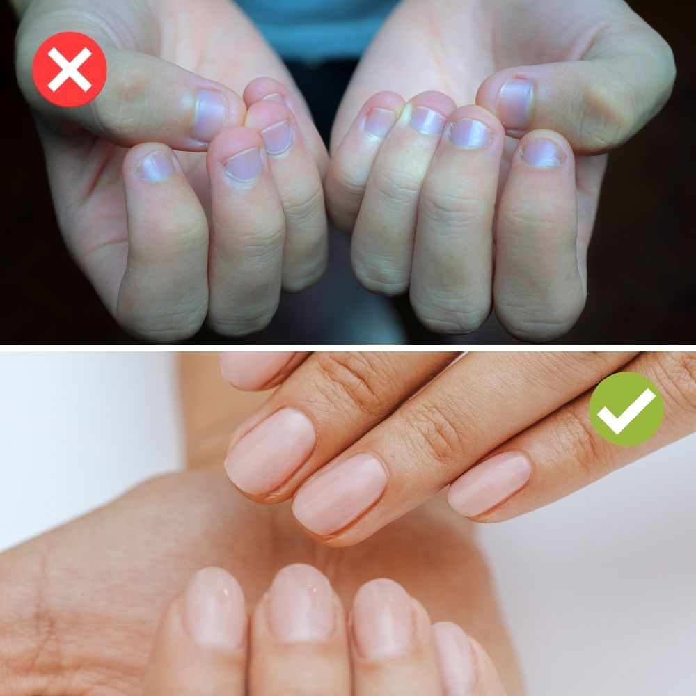 NailMaster™ - Schneidet selbst die härtesten Nägel und Nagelecken mit Leichtigkeit!