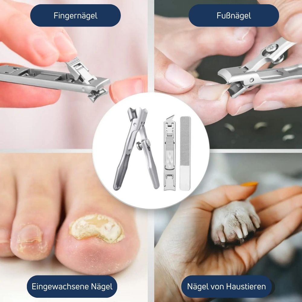 NailMaster™ - Schneidet selbst die härtesten Nägel und Nagelecken mit Leichtigkeit!